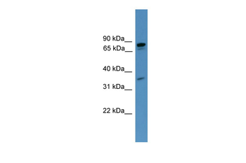 PDE8A Rabbit Polyclonal Antibody