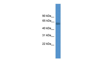 PKM2 Rabbit Polyclonal Antibody