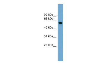 PKM2 Rabbit Polyclonal Antibody