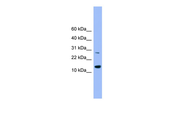 GLRX2 Rabbit Polyclonal Antibody