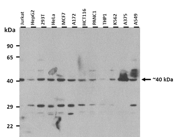 PRKACA Rabbit Polyclonal Antibody