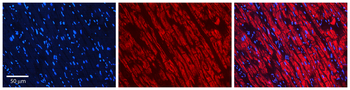 PRKACA Rabbit Polyclonal Antibody