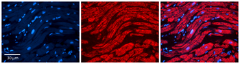 PRKACA Rabbit Polyclonal Antibody