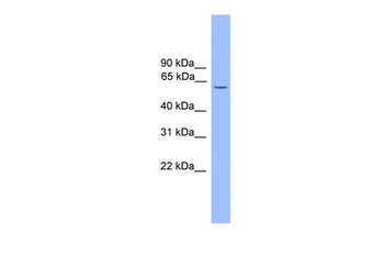 ARIH2 Rabbit Polyclonal Antibody