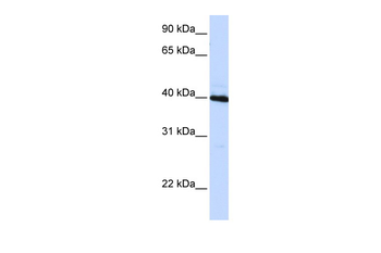 CEBPB Rabbit Polyclonal Antibody