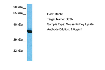GTF2B Rabbit Polyclonal Antibody