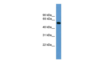 CALR Rabbit Polyclonal Antibody