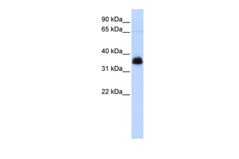 AIP Rabbit Polyclonal Antibody