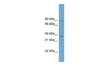 GTF2A1 Rabbit Polyclonal Antibody