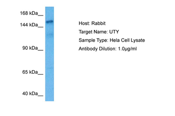 UTY Rabbit Polyclonal Antibody