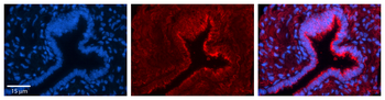 PHLDA2 Rabbit Polyclonal Antibody