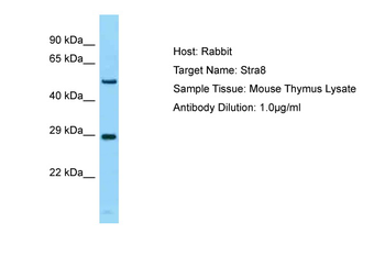 NAP1L1 Rabbit Polyclonal Antibody