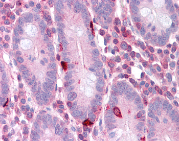 EEF2 Rabbit Polyclonal Antibody