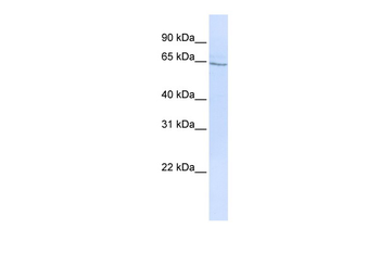 GLP2R Rabbit Polyclonal Antibody
