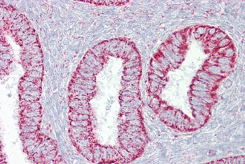 PDGFB Rabbit Polyclonal Antibody