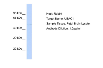 UBAC1 Rabbit Polyclonal Antibody