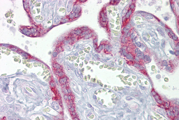 Tfam Rabbit Polyclonal Antibody