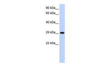 Tfam Rabbit Polyclonal Antibody