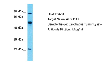 ALDH1A1 Rabbit Polyclonal Antibody