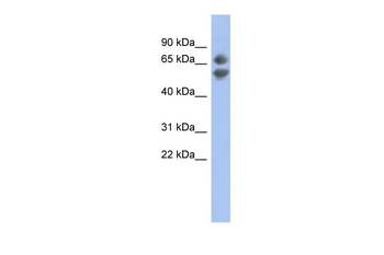 PDCD7 Rabbit Polyclonal Antibody