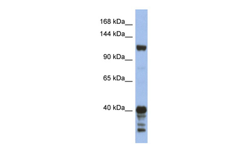 SIPA1 Rabbit Polyclonal Antibody