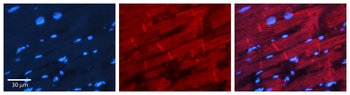 CALR Rabbit Polyclonal Antibody