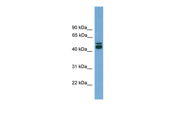 CALR Rabbit Polyclonal Antibody
