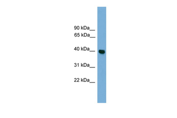 GNAI3 Rabbit Polyclonal Antibody