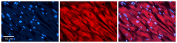 PEA15 Rabbit Polyclonal Antibody