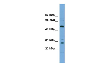 ULK3 Rabbit Polyclonal Antibody