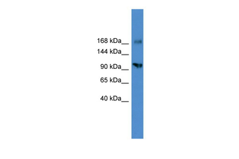 AXL Rabbit Polyclonal Antibody