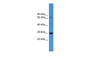 HMGB1 Rabbit Polyclonal Antibody