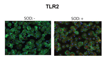 TLR2 Rabbit Polyclonal Antibody