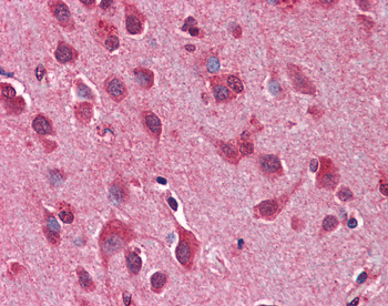 TLR2 Rabbit Polyclonal Antibody