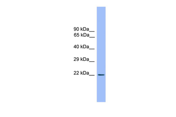 CD3E Rabbit Polyclonal Antibody