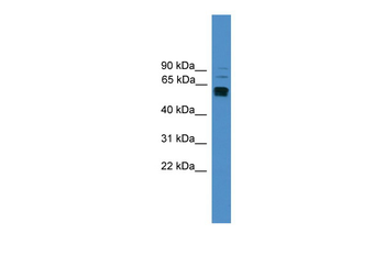 LAG3 Rabbit Polyclonal Antibody