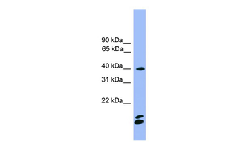 NFATC1 Rabbit Polyclonal Antibody