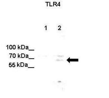 TLR4 Rabbit Polyclonal Antibody