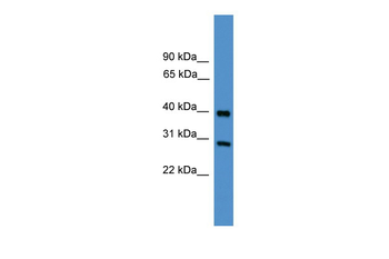 TIMP2 Rabbit Polyclonal Antibody