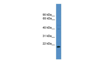 TIMP3 Rabbit Polyclonal Antibody