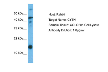CST1 Rabbit Polyclonal Antibody