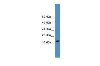 SLPI Rabbit Polyclonal Antibody