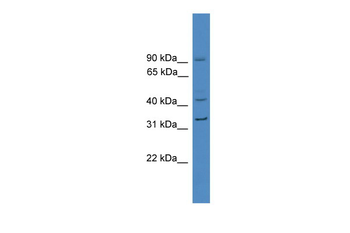 SERPINE1 Rabbit Polyclonal Antibody