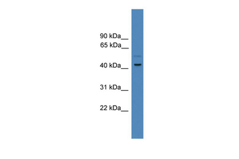SERPINE1 Rabbit Polyclonal Antibody