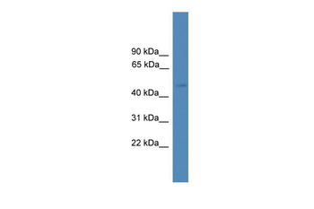 SERPINA10 Rabbit Polyclonal Antibody