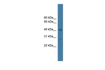 SERPINB7 Rabbit Polyclonal Antibody