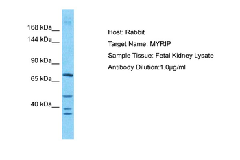 MYRIP Rabbit Polyclonal Antibody