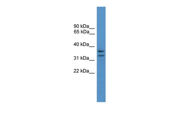 SCAMP3 Rabbit Polyclonal Antibody