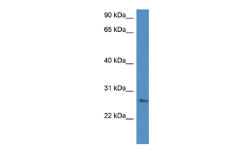 CMA1 Rabbit Polyclonal Antibody