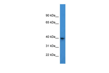 ARPM1 Rabbit Polyclonal Antibody